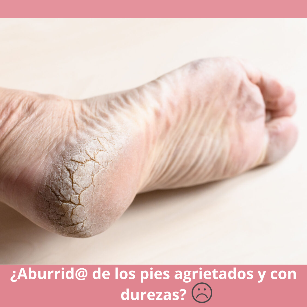 Removedor de callos - RECARGABLE